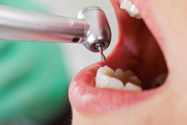 Best Broken or Chipped Tooth Repair in Big Rapids, MI